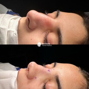 Barcelona Facial Plastics _2