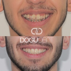 DoğuDent Dental Clinic _1