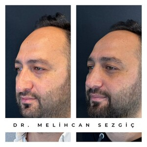 Melih Can Sezgiç _3