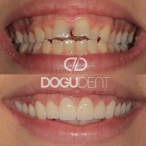 DoğuDent Dental Clinic _0