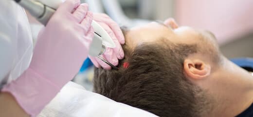 Guide to Laser Hair Therapy for Hair Growth