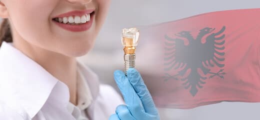 Dental Implants in Albania vs Other Countries