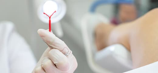 IUD - Intrauterine Device (Fertility)