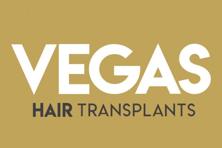 Vegas Hair Transplants