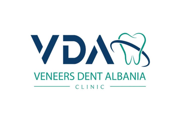 Veneers Dent Albania Clinic