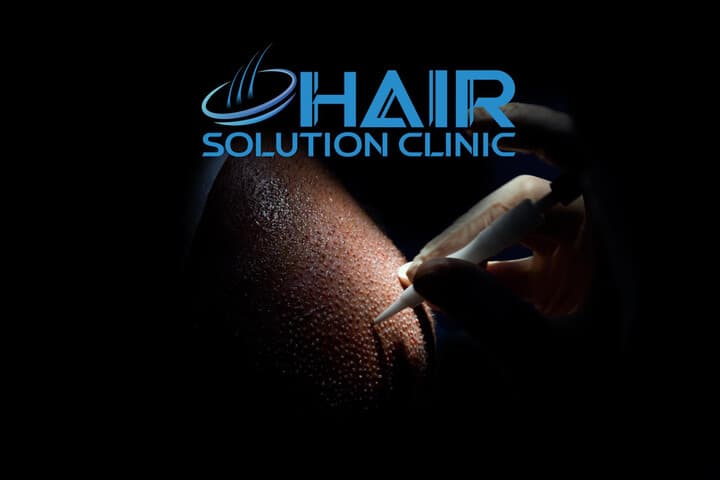 Hair Solution Clinic Albania