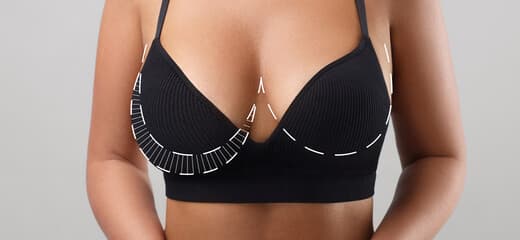 The Ultimate Guide to Breast Reduction